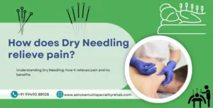 How does Dry needling relieve pain?